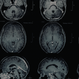 Brain scans in rows